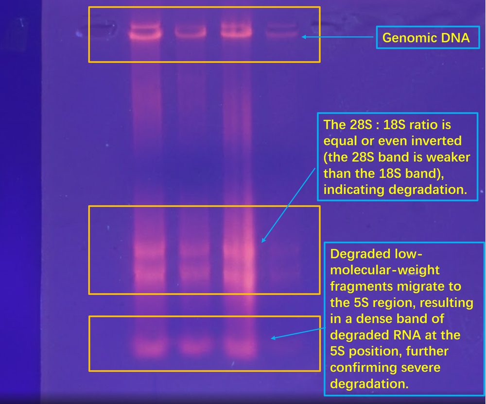 Annotated RNA gel — 28S/18S ratio inversion and 5S smear explained